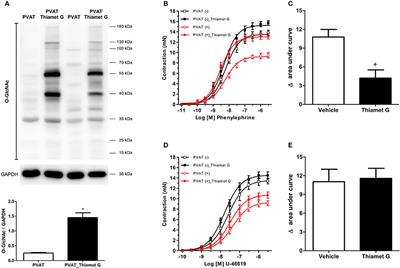 Increased O-GlcNAcylation of Endothelial Nitric Oxide Synthase Compromises the Anti-contractile Properties of Perivascular Adipose Tissue in Metabolic Syndrome